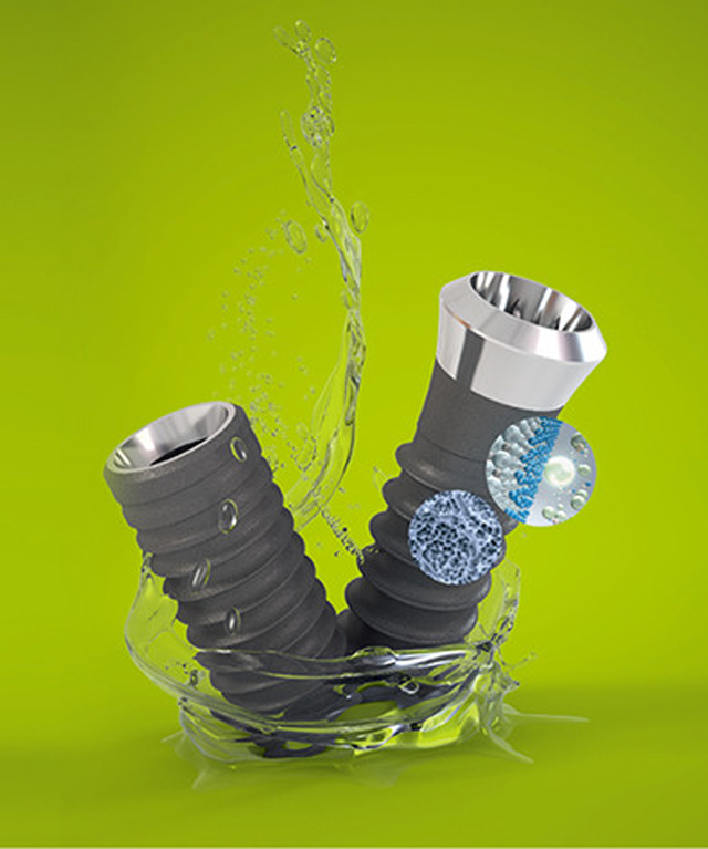 스트라우만 임플란트