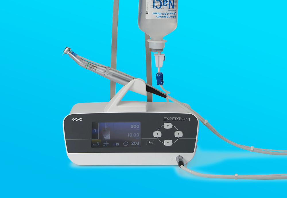 고성능 임플란트 엔진